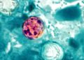 How Trump admin cuts have compromised food safety